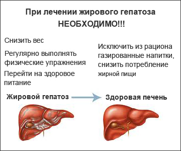 Лечение гепатита с жировым гепатозом