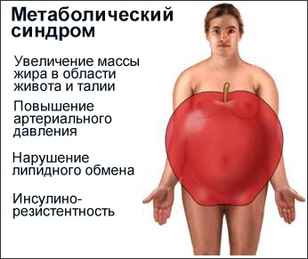 Метаболический синдром - увеличением массы жира в области живота, талии, органов брюшной полости